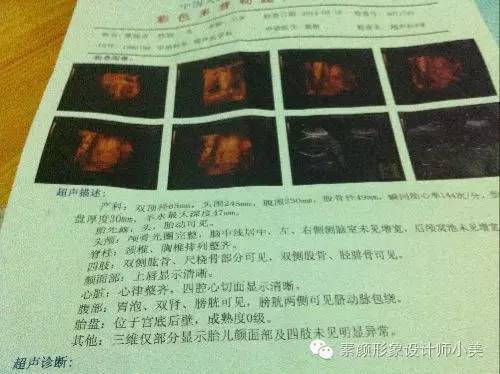 孕育讲解直播,孕育早课堂