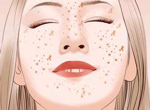 日光性皮炎最佳治疗方法,日光性皮炎如何没有斑