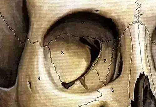 割双眼皮后悔的多还是不后悔的多,割双眼皮为什么前30天就那么难看