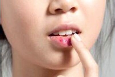 韩国化妆品还有假货吗,315曝光韩国化妆品