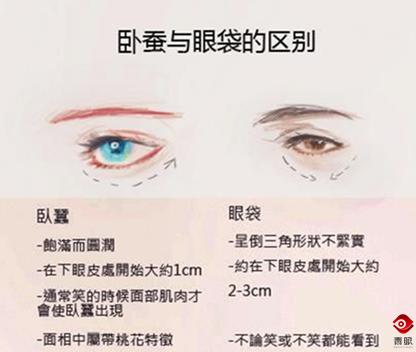 卧蚕跟酒窝的区别,有卧蚕酒窝泪痣为什么丑