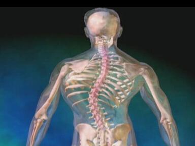 脊柱侧凸手术遭罪吗,脊柱侧凸正确睡姿图