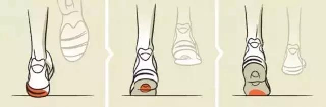 选鞋不当危害,适合内翻外翻的跑鞋