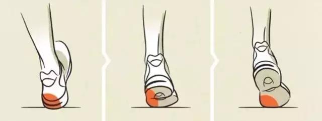 选鞋不当危害,亚瑟士跑鞋适合外翻还是内翻