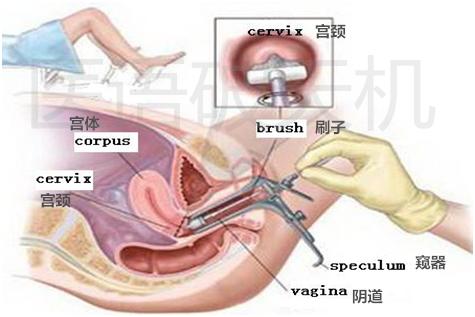 男子确诊阴茎癌手术后发现误诊,男子被确诊阴茎癌手术切除误诊