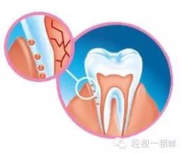 儿童电动牙刷的正确刷牙方法,电动牙刷儿童用