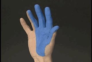 右正中神经在哪里,正中神经手部分支