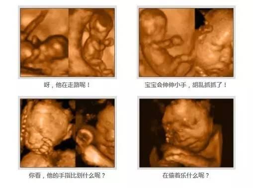 做b超要憋尿是早晨不尿吗,做b超为啥非得憋尿