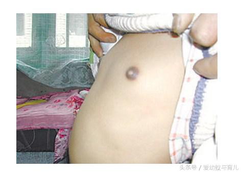 不到三岁的女宝宝来月经，医生的话让宝妈伤心痛哭不止