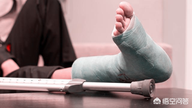 脚后跟骨粉碎性骨折有后遗症,脚后跟粉碎骨折的后遗症