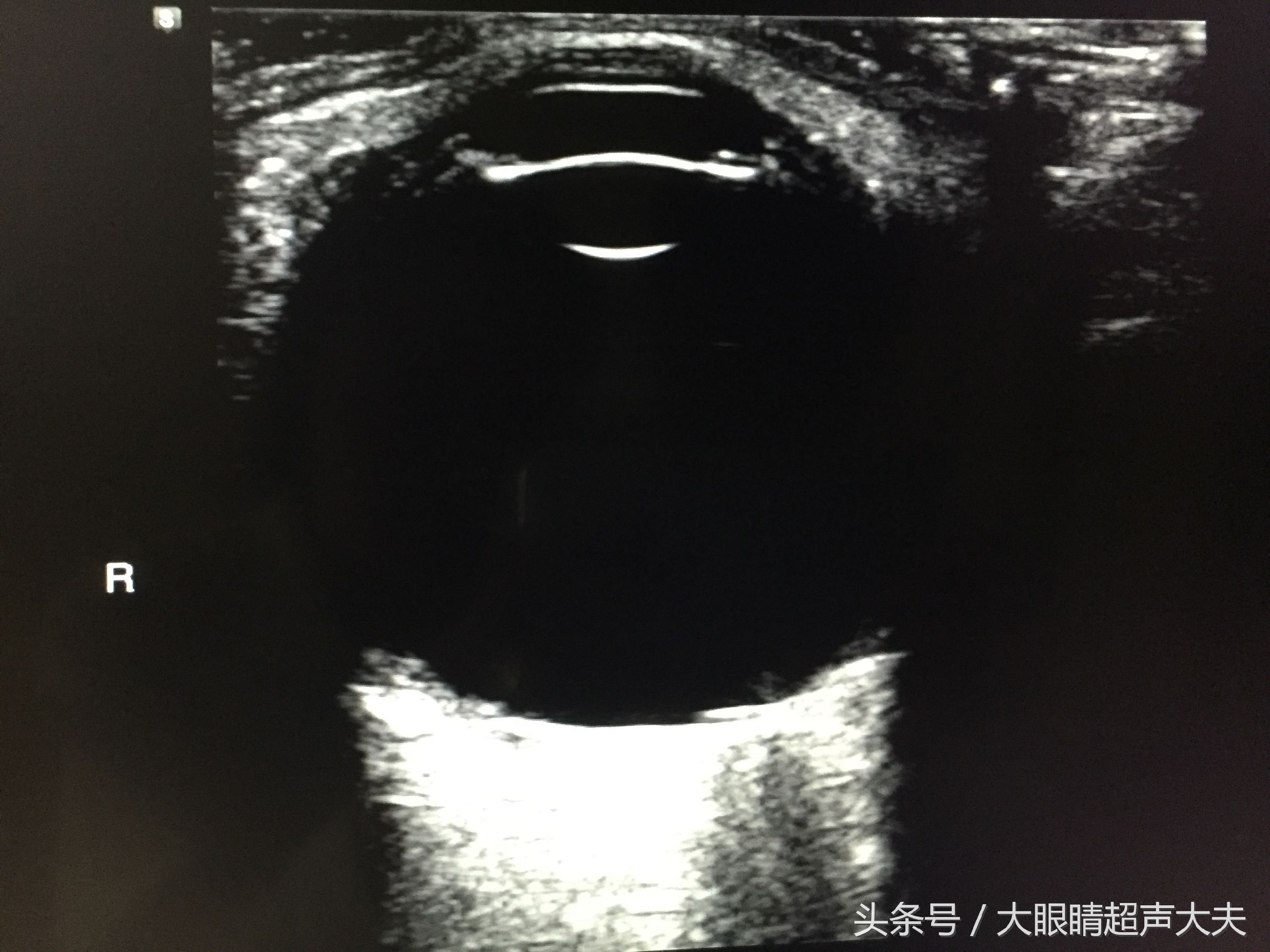 超声检查报告单搞笑图,有趣的超声图