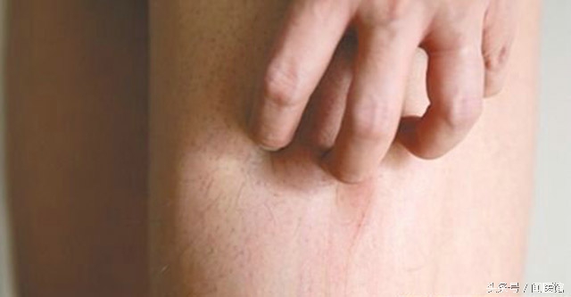 洗澡皮肤痒用什么能止痒,皮肤瘙痒用什么洗澡能止痒