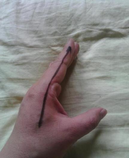 今天宝宝发烧了,便秘发烧怎么退烧