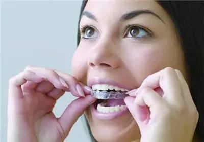 矫牙经历的几个阶段,科普牙齿矫正一定要拔牙吗