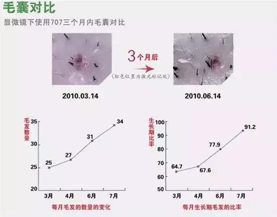 白发补染发根与染全头哪个危害大,染白发发根染黑了怎么处理