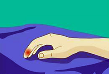 手指被注射器戳伤关节凸起怎么办,手指指根戳伤了怎么用胶带处理