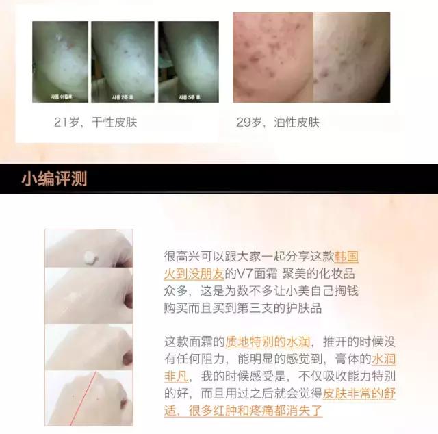 祛痘疤痘印粉刺,Dr.Jart韩国蒂佳婷V7维生素修复霜