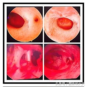 医生最讨厌的4种人,医生最讨厌的几种病人