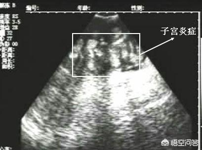 母猪产后消炎用什么药合适,母猪产后慎用的抗生素