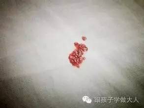孕期准妈出现腹痛多是这几种原因，种种都很要命！