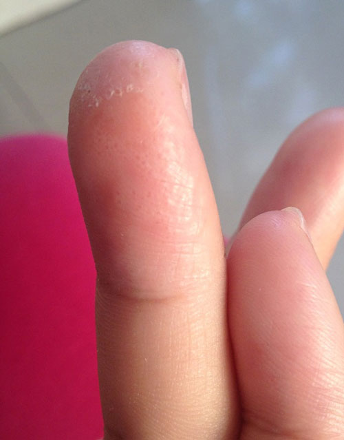 8岁男孩身患怪病,男孩患怪病的真实案例