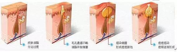 最毁容的皮肤病,最致命最严重的几种皮肤病