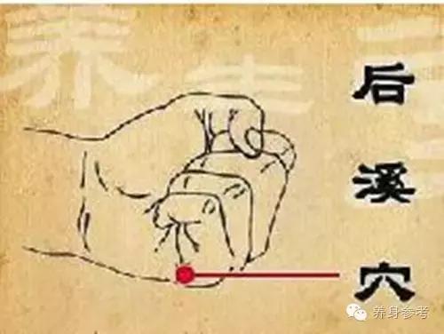 董氏奇穴治疗偏头痛,生小孩神经痛针灸