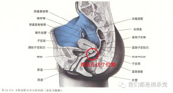 来例假用棉条可以下海游泳吗,用月经棉条可以下水游泳吗