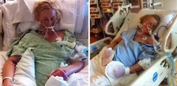 卫生棉会引发炎症吗,卫生棉中毒死亡事件