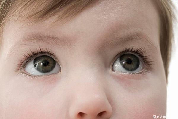 宝宝眼睛比较常见的病,宝宝眼睛疾病有哪些