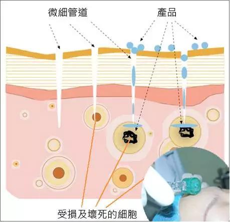 名医专访,专家医生谈敏感肌肤