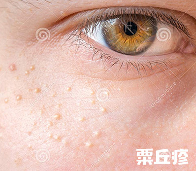 星星眼的小技巧,如何轻松get星星眼