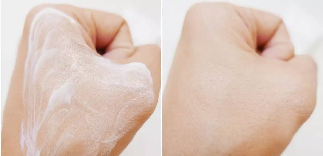 孕期敏感肌肤,孕期敏感肌用什么护肤品