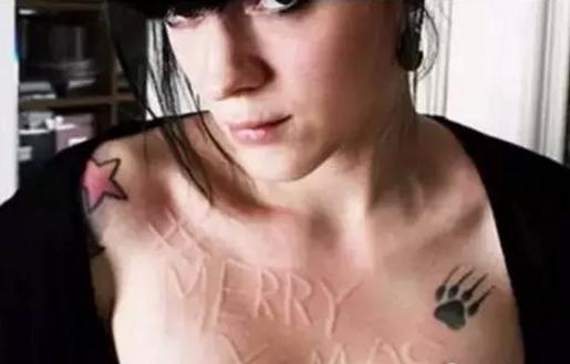 麻疹能治断根吗,麻疹治得好吗