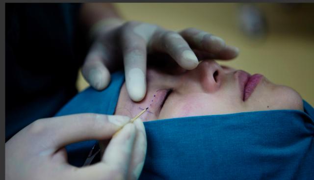 为什么大家都喜欢大眼睛双眼皮,为什么大家喜欢做双眼皮手术