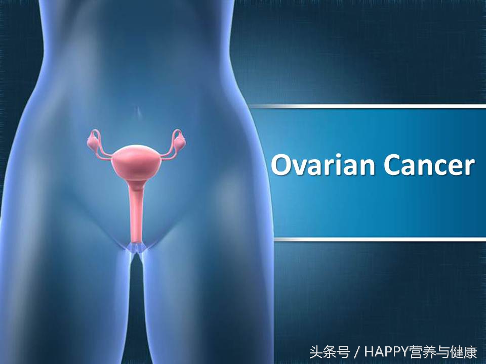女性结扎会降低患卵巢癌的风险吗,卵巢癌预防五大方法