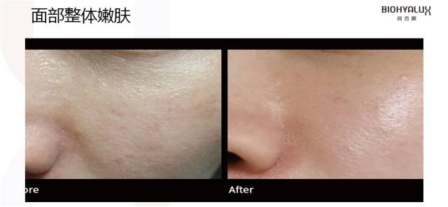 夏季必备补水利器,这个季节最好的补水产品