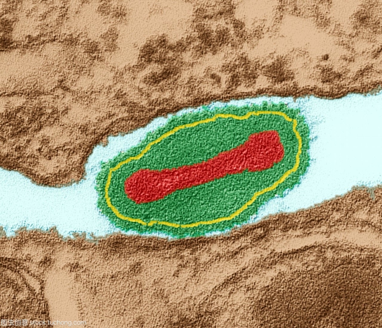 第一种被人类消灭的致命病毒,2100年致命病毒
