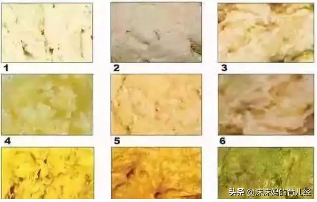 宝宝拉绿色便便还拉稀什么原因,宝宝拉绿色便便是感冒了