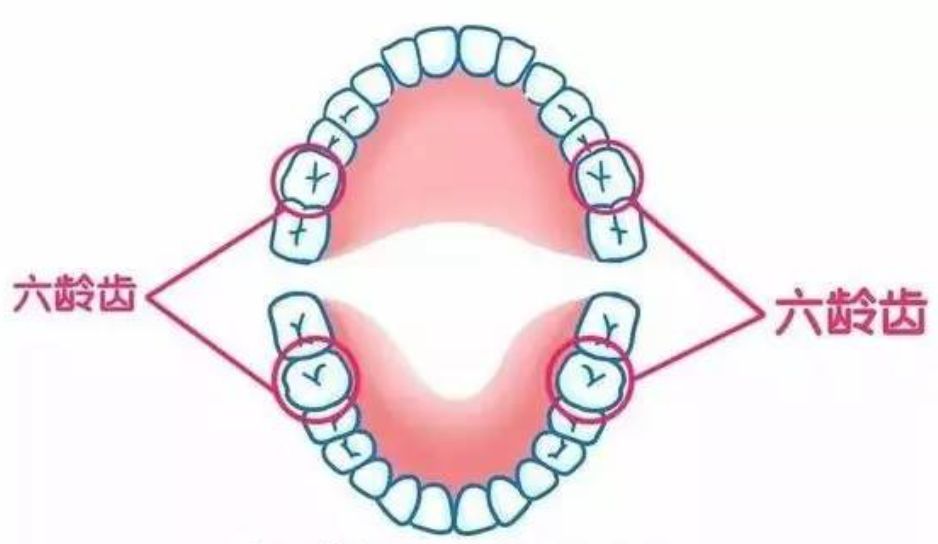认真刷牙、不吃糖的娃竟得了10颗蛀牙，只因家长疏忽了这4点