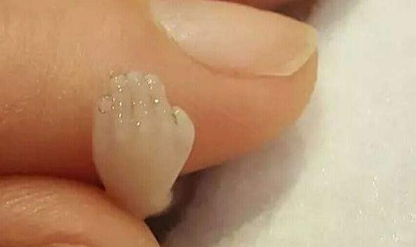 人工流产的胎儿都哪里去了,人工流产胎儿要怎么处理