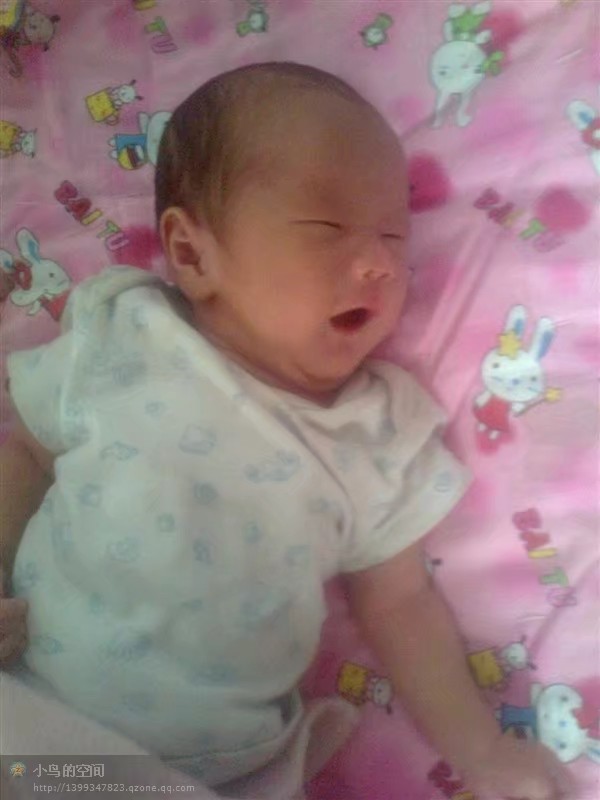 第二次剖腹产经历,第二次剖腹产还是在原来的疤上吗