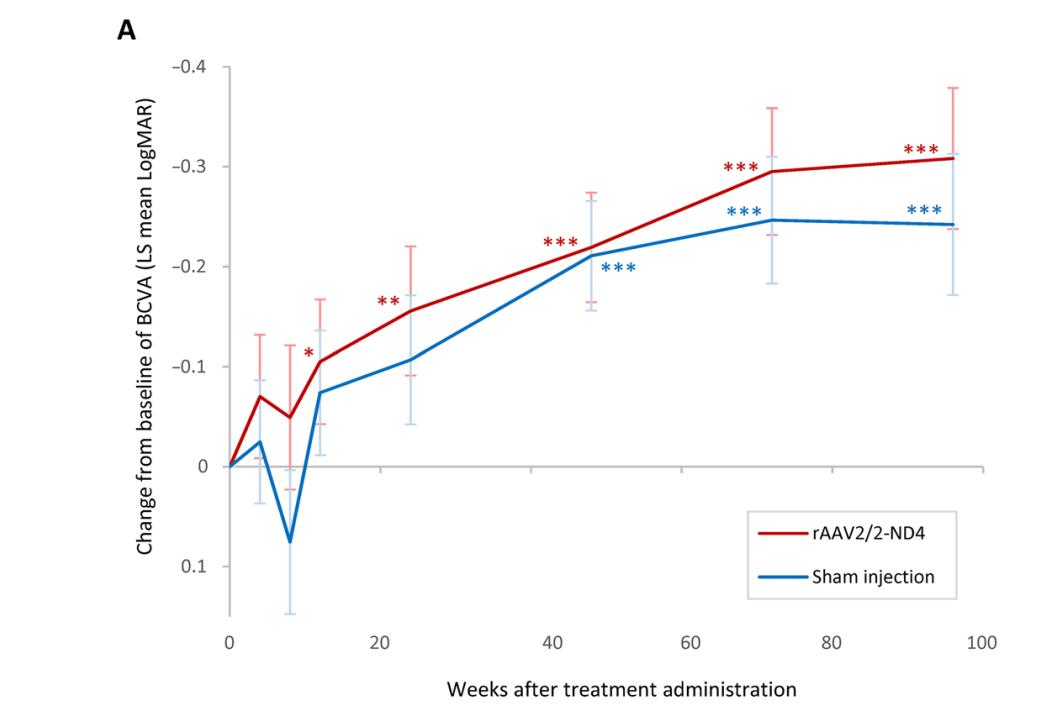 基因治疗青光眼的新消息,基因治疗青光眼的最新消息