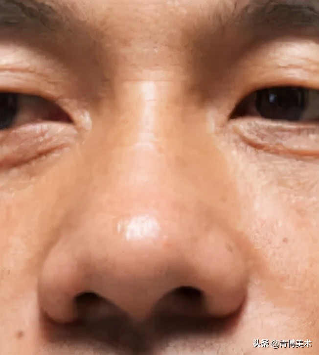 鼻子看起来很塌又不塌,鼻子看着没立体感