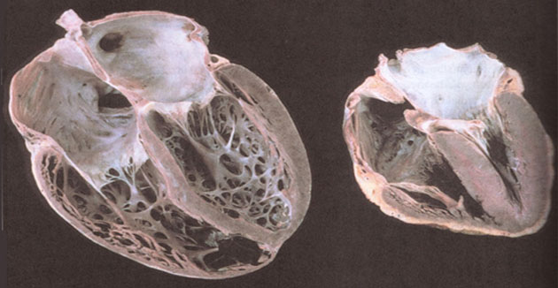 降温心脑血管病患者,气温骤降心血管病人要当心