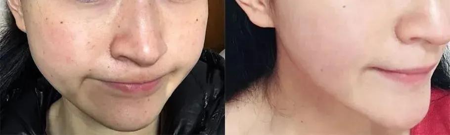 死海泥洗面膜怎么样,死海泥面膜的神奇功效是什么