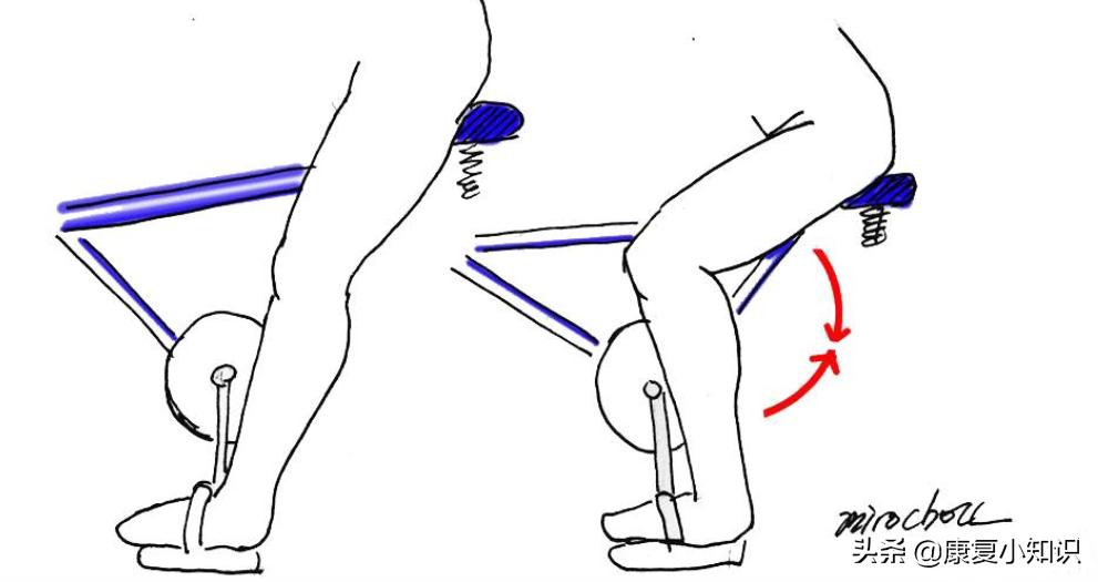 大腿后侧疼痛的位置图,大腿后侧根部疼痛