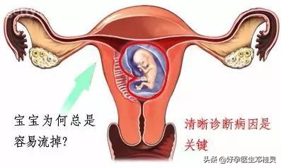 多次胎停育,复发性流产导致不孕?医生:人家经过治疗已经怀孕了