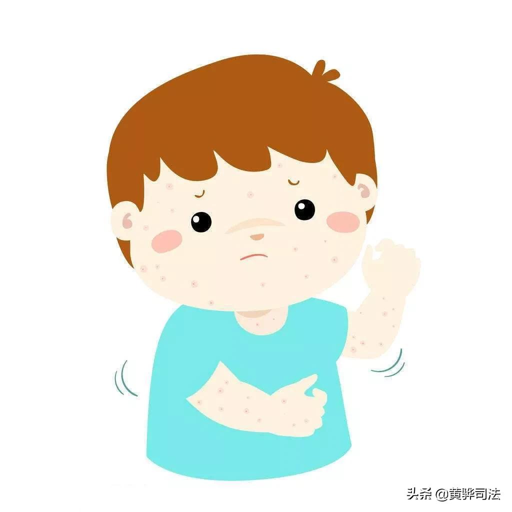 水痘高发期要注意什么,水痘进入高发期专家支招如何预防