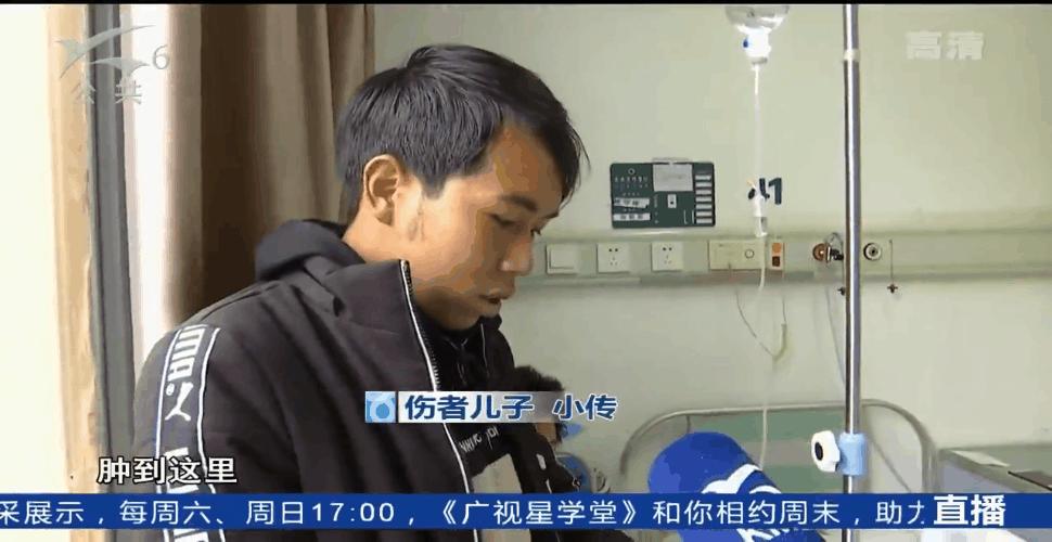 好可怕！老师傅手臂肿成这样险些截肢，只是因为被树皮扎了个小口子